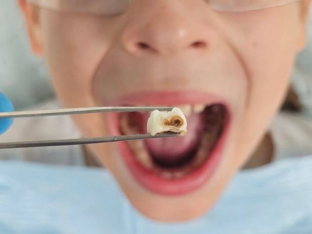 Best After-Hours Dental Trauma Care in Guilford Center, CT
