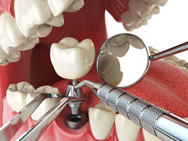 Best Urgent Care for Lost Fillings or Crowns in Guilford Center, CT