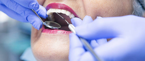 Best Emergency Tooth Extraction in Guilford Center, CT